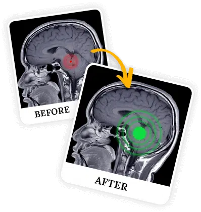 billionaire brain wave program